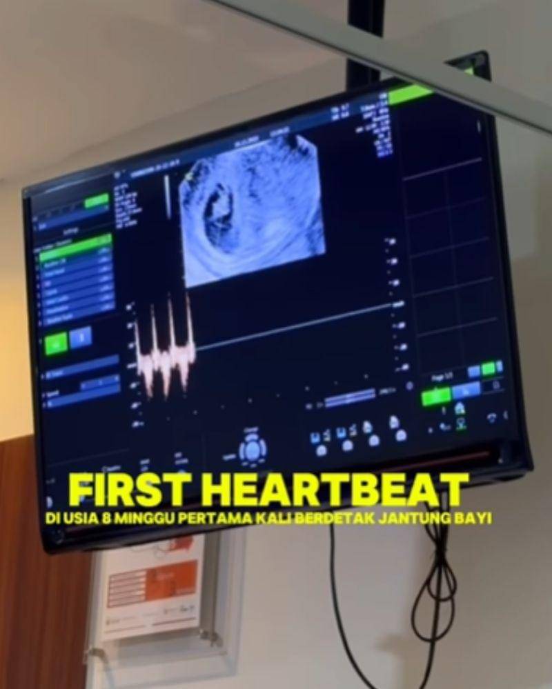 Instagram.com/sumargodenny